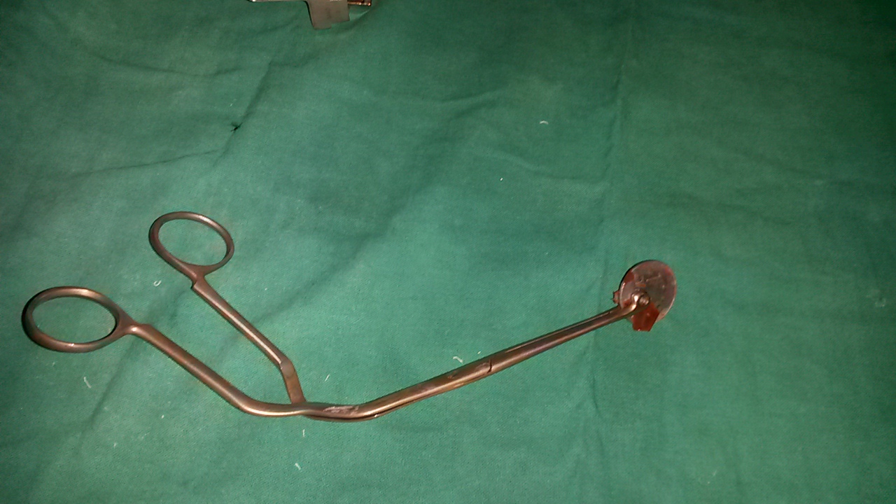 Bronchoscopy Image 1